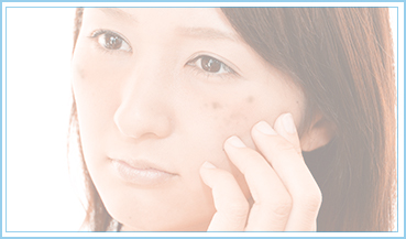 しみ・そばかす